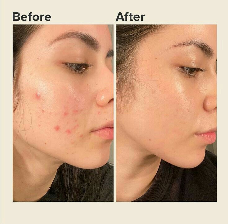 Collagen Night Wrapping Face Mask | Buy 1 Get 1 Free